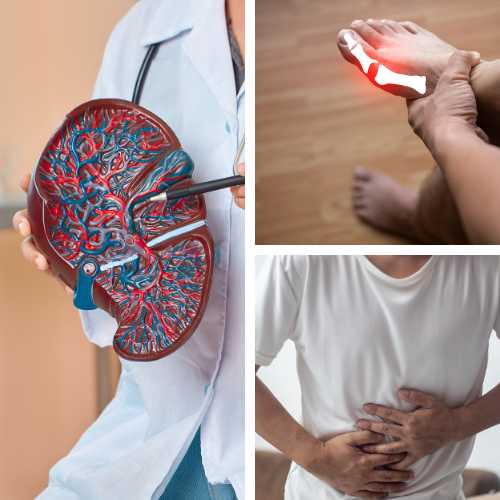 Fatty Liver & Uric Acid Issues